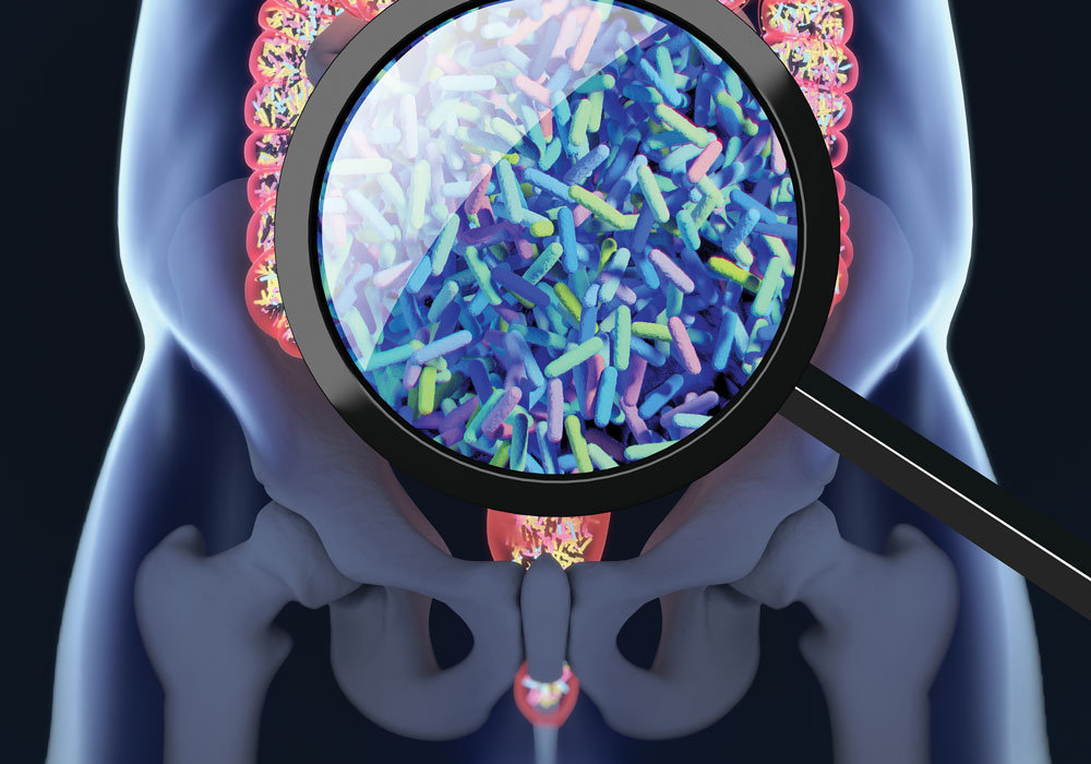 Two Bacteria Species Connected to Certain Colon Cancers 