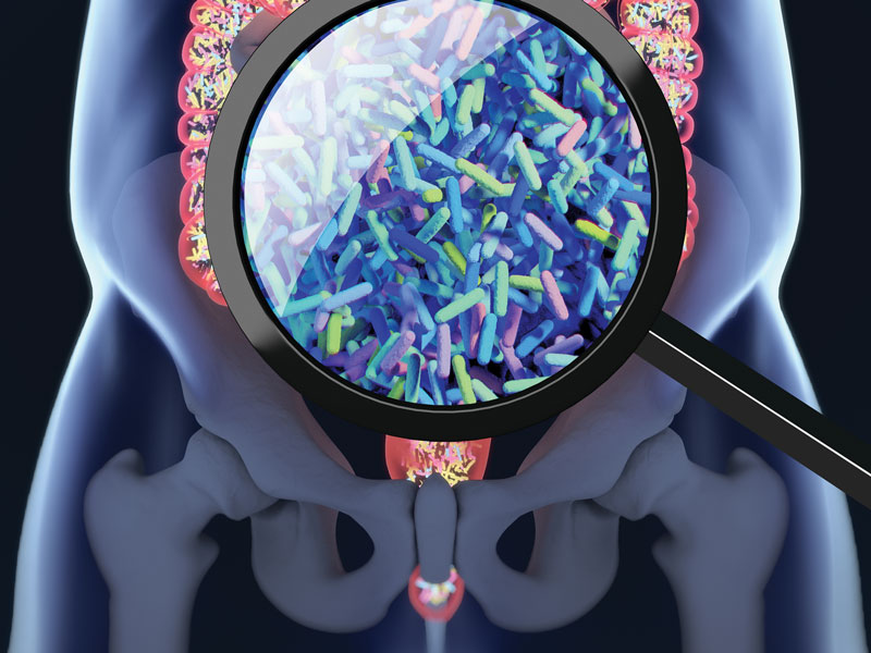 Two Bacteria Species Connected to Certain Colon Cancers 