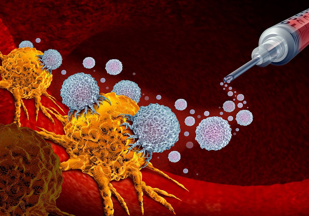 Immunotherapy Is Changing the Treatment Landscape for Advanced Bladder Cancer 