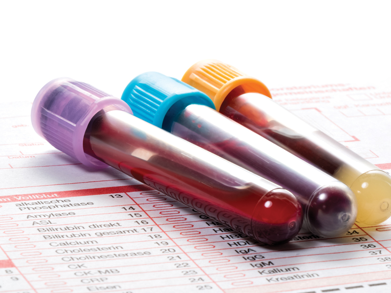 blood test to detect cancer