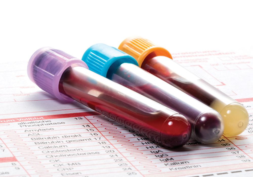 blood test to detect cancer