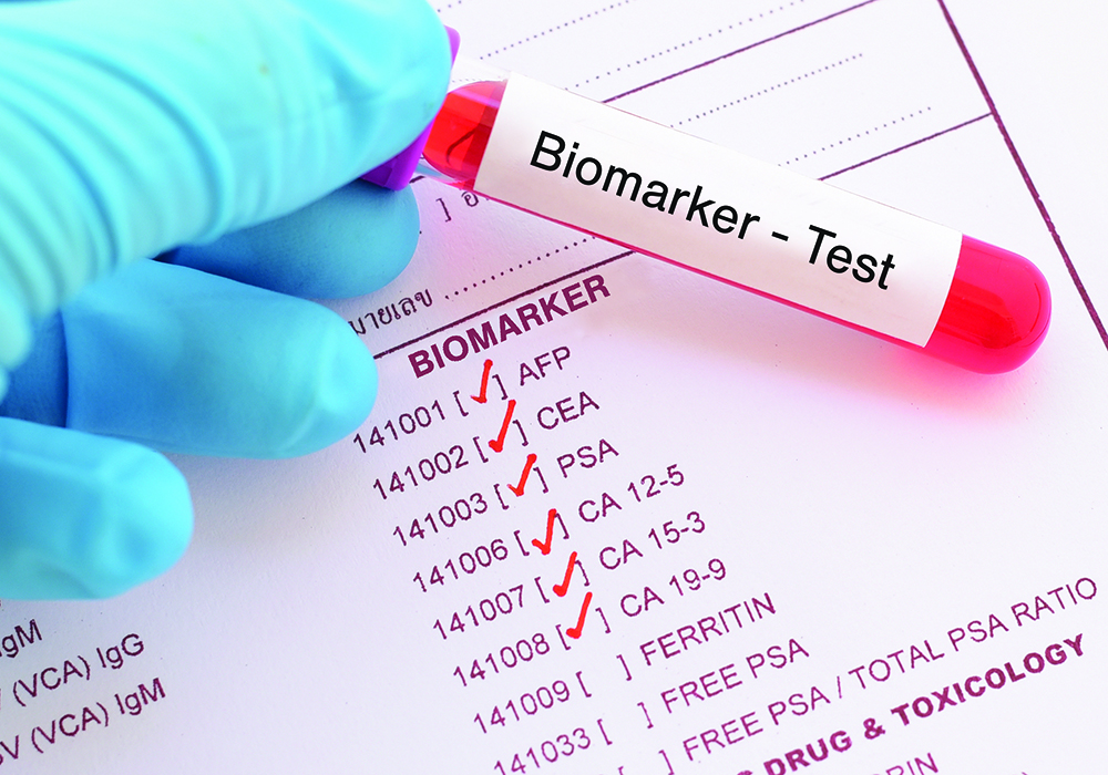 Oncology Nurses’ Role in Translating Biomarker Testing Results