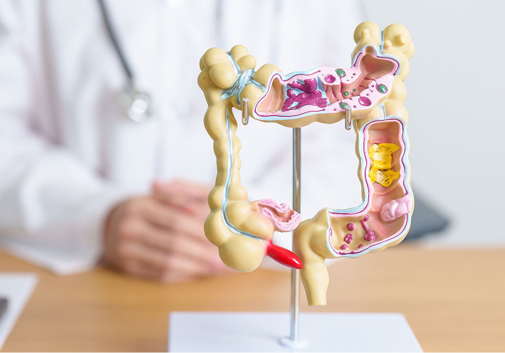 Healthcare provider sitting behind a colorectal cancer model