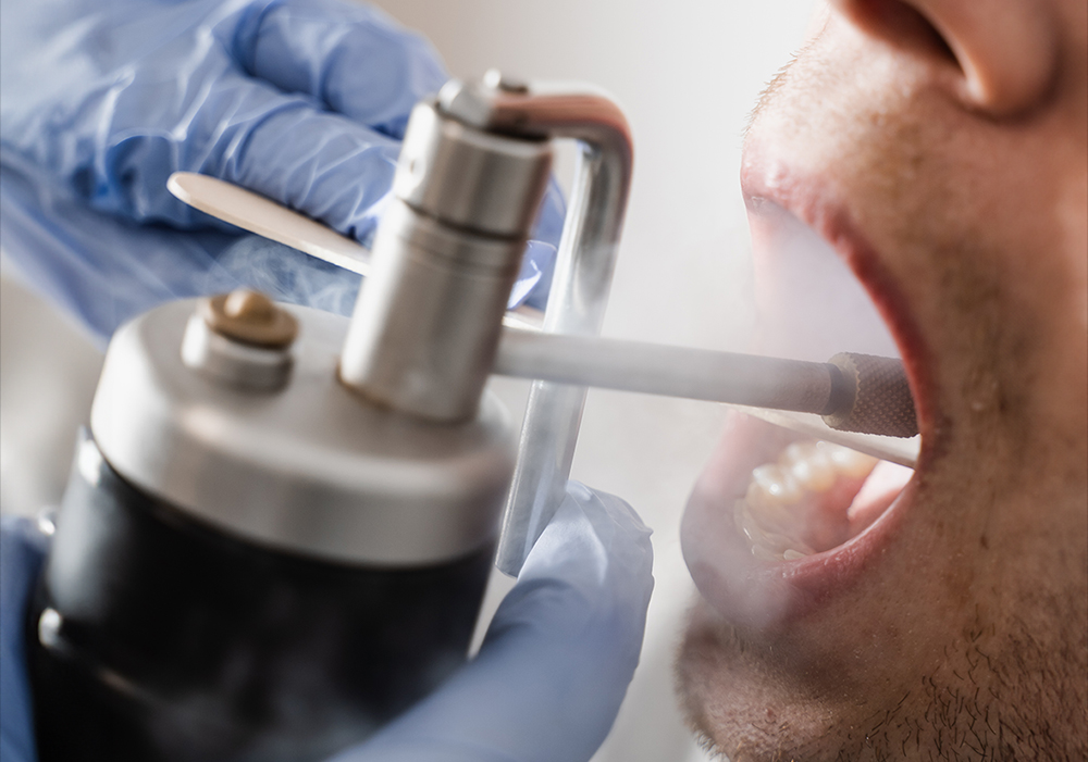 cryotherapy in mouth